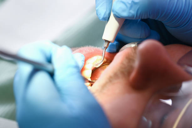 Best Emergency Denture Repair in Port Neches, TX
